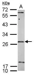 Anti-U1SNRNPBP antibody [N2C3] used in Western Blot (WB). GTX119546