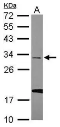 Anti-U1SNRNPBP antibody [N2C3] used in Western Blot (WB). GTX119546