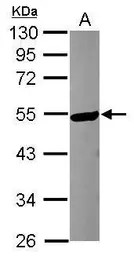 Anti-KATNA1 antibody [N2C2], Internal used in Western Blot (WB). GTX119548