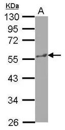 Anti-KATNA1 antibody [N1N3] used in Western Blot (WB). GTX119549