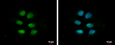 Anti-ZNF571 antibody [N1N2], N-term used in Immunocytochemistry/ Immunofluorescence (ICC/IF). GTX119554