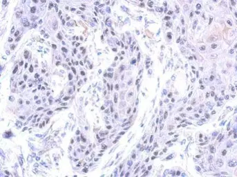 Anti-ZNF571 antibody [N1N2], N-term used in IHC (Paraffin sections) (IHC-P). GTX119554