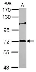 Anti-ZNF571 antibody [N1N2], N-term used in Western Blot (WB). GTX119554