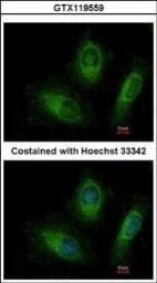 Anti-RAB20 antibody [N1C3] used in Immunocytochemistry/ Immunofluorescence (ICC/IF). GTX119559