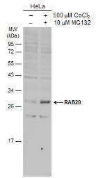 Anti-RAB20 antibody [N1C3] used in Western Blot (WB). GTX119559