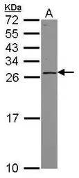Anti-PSF3 antibody [N1C3] used in Western Blot (WB). GTX119563