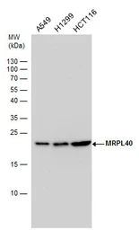 Anti-MRPL40 antibody used in Western Blot (WB). GTX119564