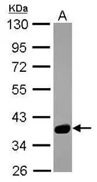 Anti-SPSB3 antibody [N1C2] used in Western Blot (WB). GTX119568