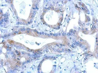 Anti-RNF166 antibody [N1C3] used in IHC (Paraffin sections) (IHC-P). GTX119570