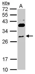 Anti-RNF166 antibody [N1C3] used in Western Blot (WB). GTX119570