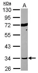Anti-SEPT12 antibody used in Western Blot (WB). GTX119571