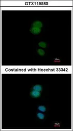Anti-ZNF584 antibody [N3C3] used in Immunocytochemistry/ Immunofluorescence (ICC/IF). GTX119580