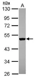 Anti-ZNF584 antibody [N3C3] used in Western Blot (WB). GTX119580