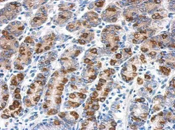 Anti-CYB5R1 antibody [N3C3] used in IHC (Paraffin sections) (IHC-P). GTX119589