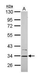 Anti-CYB5R1 antibody [N3C3] used in Western Blot (WB). GTX119589