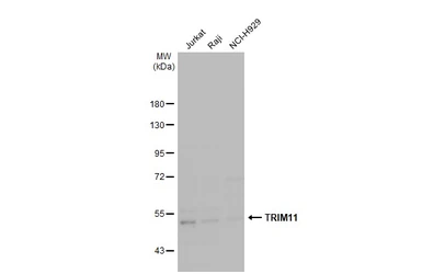 Anti-TRIM11 antibody [N3C3] used in Western Blot (WB). GTX119592