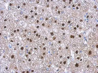 Anti-TRIM11 antibody [N3C3] used in IHC (Paraffin sections) (IHC-P). GTX119592