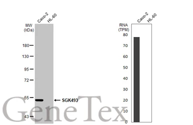 Anti-SGK493 antibody [N2C2], Internal used in Western Blot (WB). GTX119593
