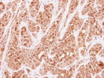 Anti-SGK493 antibody [N2C2], Internal used in IHC (Paraffin sections) (IHC-P). GTX119593