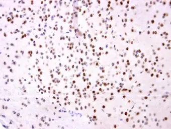 Anti-OTP antibody used in IHC (Paraffin sections) (IHC-P). GTX119601