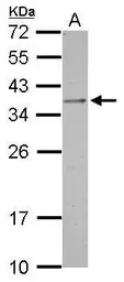 Anti-OTP antibody used in Western Blot (WB). GTX119601