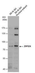 Anti-ZNF624 antibody used in Western Blot (WB). GTX119609