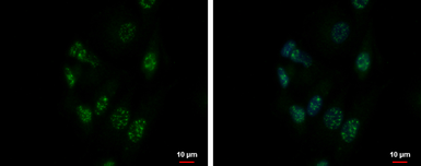 Anti-ZNF624 antibody used in Immunocytochemistry/ Immunofluorescence (ICC/IF). GTX119609