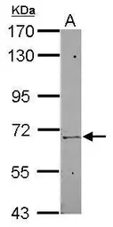 Anti-ZNF319 antibody [N1C1] used in Western Blot (WB). GTX119611