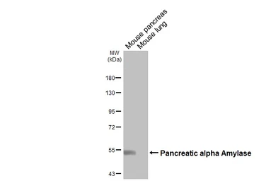Anti-alpha Amylase antibody [N2C2], Internal used in Western Blot (WB). GTX119617