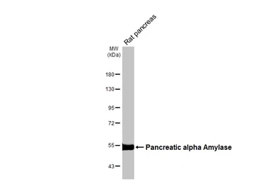 Anti-alpha Amylase antibody [N2C2], Internal used in Western Blot (WB). GTX119617