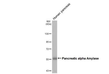 Anti-alpha Amylase antibody [N2C2], Internal used in Western Blot (WB). GTX119617