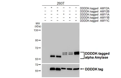 Anti-alpha Amylase antibody [N2C2], Internal used in Western Blot (WB). GTX119617