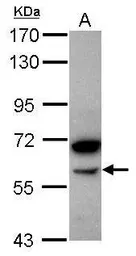 Anti-alpha amylase 2B (pancreatic) antibody [N2C2], Internal used in Western Blot (WB). GTX119617