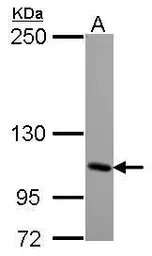 Anti-KA1 antibody [N2N3] used in Western Blot (WB). GTX119621
