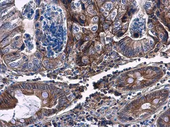 Anti-CHST4 antibody [N3C3] used in IHC (Paraffin sections) (IHC-P). GTX119636