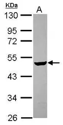 Anti-CHST4 antibody [N3C3] used in Western Blot (WB). GTX119636
