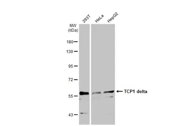 Anti-TCP1 delta antibody [N1C2] used in Western Blot (WB). GTX119638
