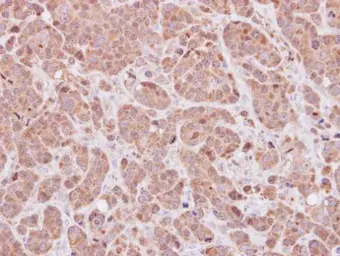 Anti-MOXD1 antibody [N2C2], Internal used in IHC (Paraffin sections) (IHC-P). GTX119649