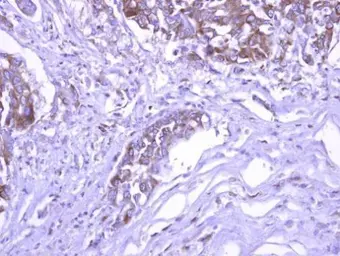 Anti-SEC3 antibody [C2C3], C-term used in IHC (Paraffin sections) (IHC-P). GTX119659