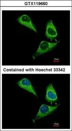 Anti-ARHGAP15 antibody [N1N3] used in Immunocytochemistry/ Immunofluorescence (ICC/IF). GTX119660