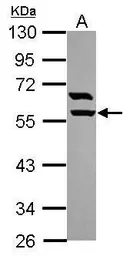 Anti-ARHGAP15 antibody [N1N3] used in Western Blot (WB). GTX119660