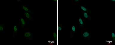 Anti-ZNF587 antibody [C1C3] used in Immunocytochemistry/ Immunofluorescence (ICC/IF). GTX119668
