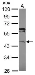 Anti-C13orf31 antibody [N3C3] used in Western Blot (WB). GTX119672