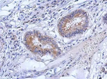 Anti-ZNF645 antibody [N2C3] used in IHC (Paraffin sections) (IHC-P). GTX119676
