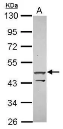 Anti-ZNF645 antibody [N2C3] used in Western Blot (WB). GTX119676