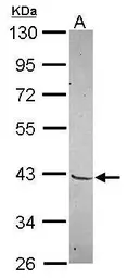 Anti-MKX antibody [N2C3] used in Western Blot (WB). GTX119679