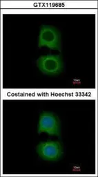 Anti-Tropomodulin 2 antibody [N3C3] used in Immunocytochemistry/ Immunofluorescence (ICC/IF). GTX119685