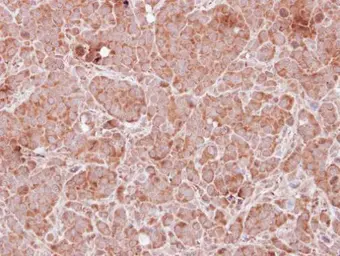 Anti-Tropomodulin 2 antibody [N3C3] used in IHC (Paraffin sections) (IHC-P). GTX119685