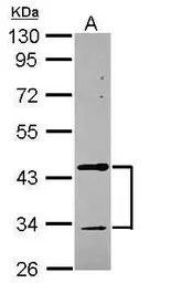 Anti-Tropomodulin 2 antibody [N3C3] used in Western Blot (WB). GTX119685