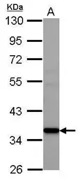 Anti-AMD1 antibody used in Western Blot (WB). GTX119689